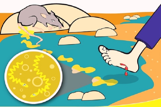 Waspadai Leptospirosis, Hindari Gunakan Air Tampungan